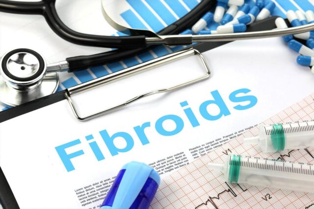 Natural Home Remedy For Fibroids